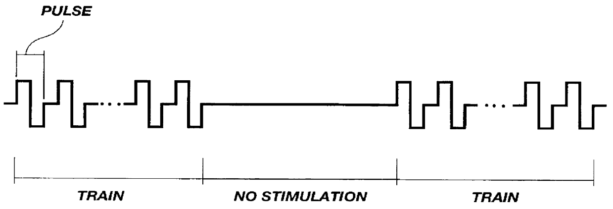 Method for introducing pharmaceutical drugs and nucleic acids into skeletal muscle