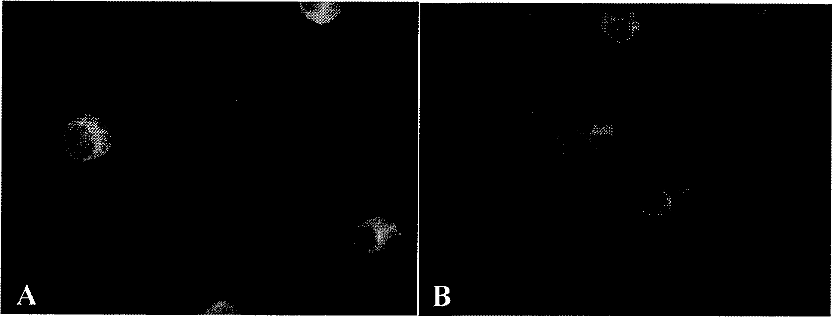 Virus velogen strain for porcine reproductive and respiratory syndrome, attenuated vaccine strain thereof and application thereof