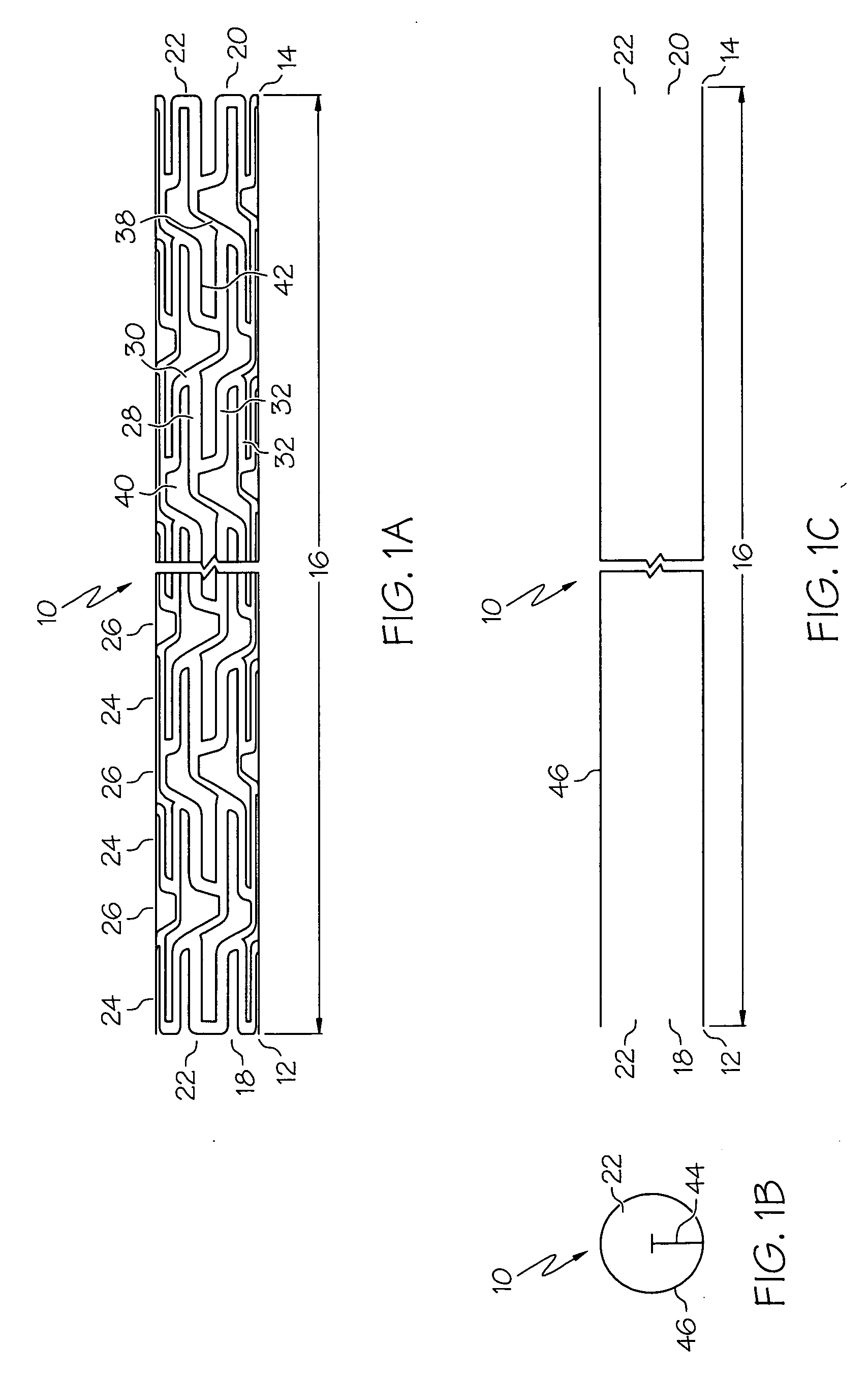 Intravascular stent