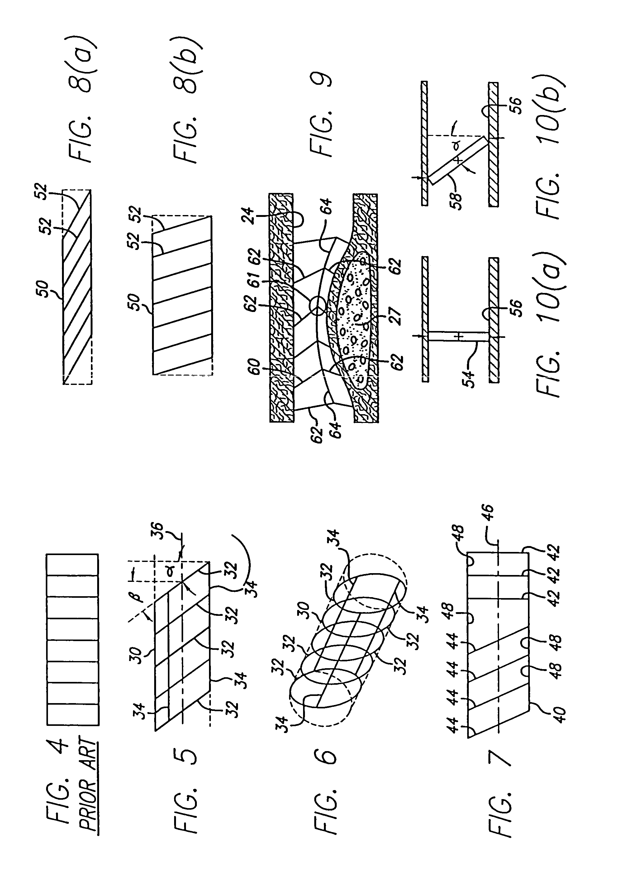 Inclined stent pattern for vulnerable plaque