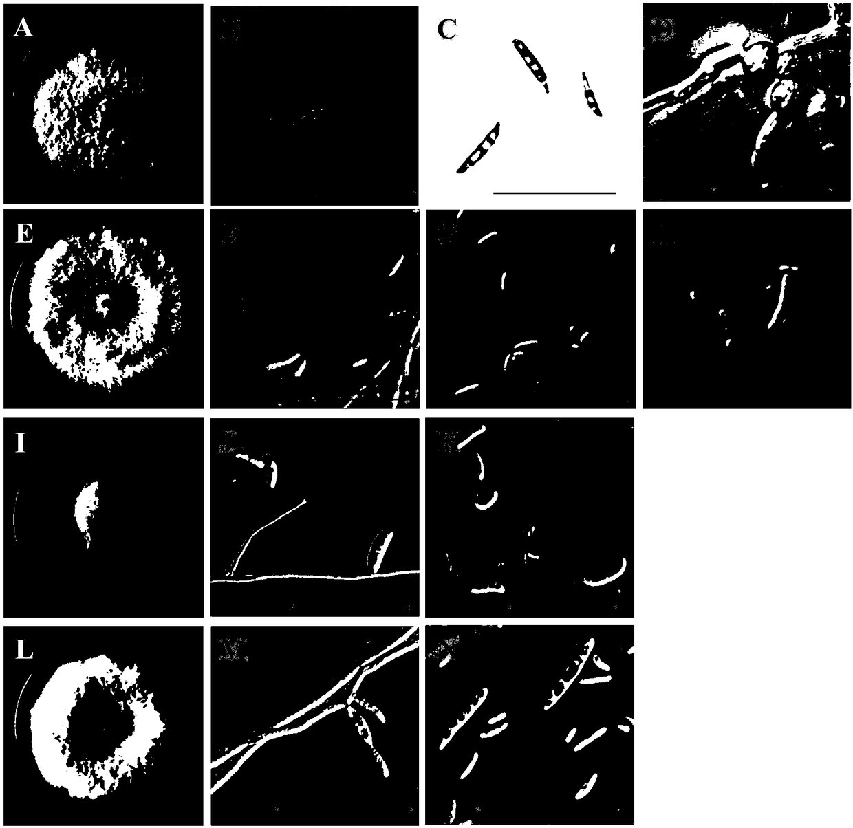 Method for authenticating and distinguishing fusarium culture causing soybean root rot