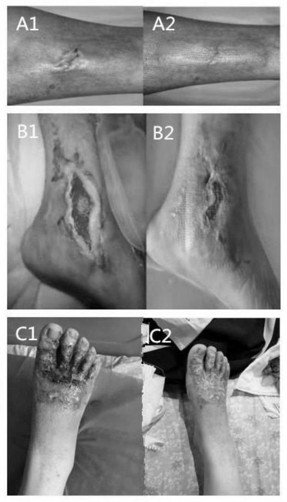 Preparation method and application of soft tissue repair material