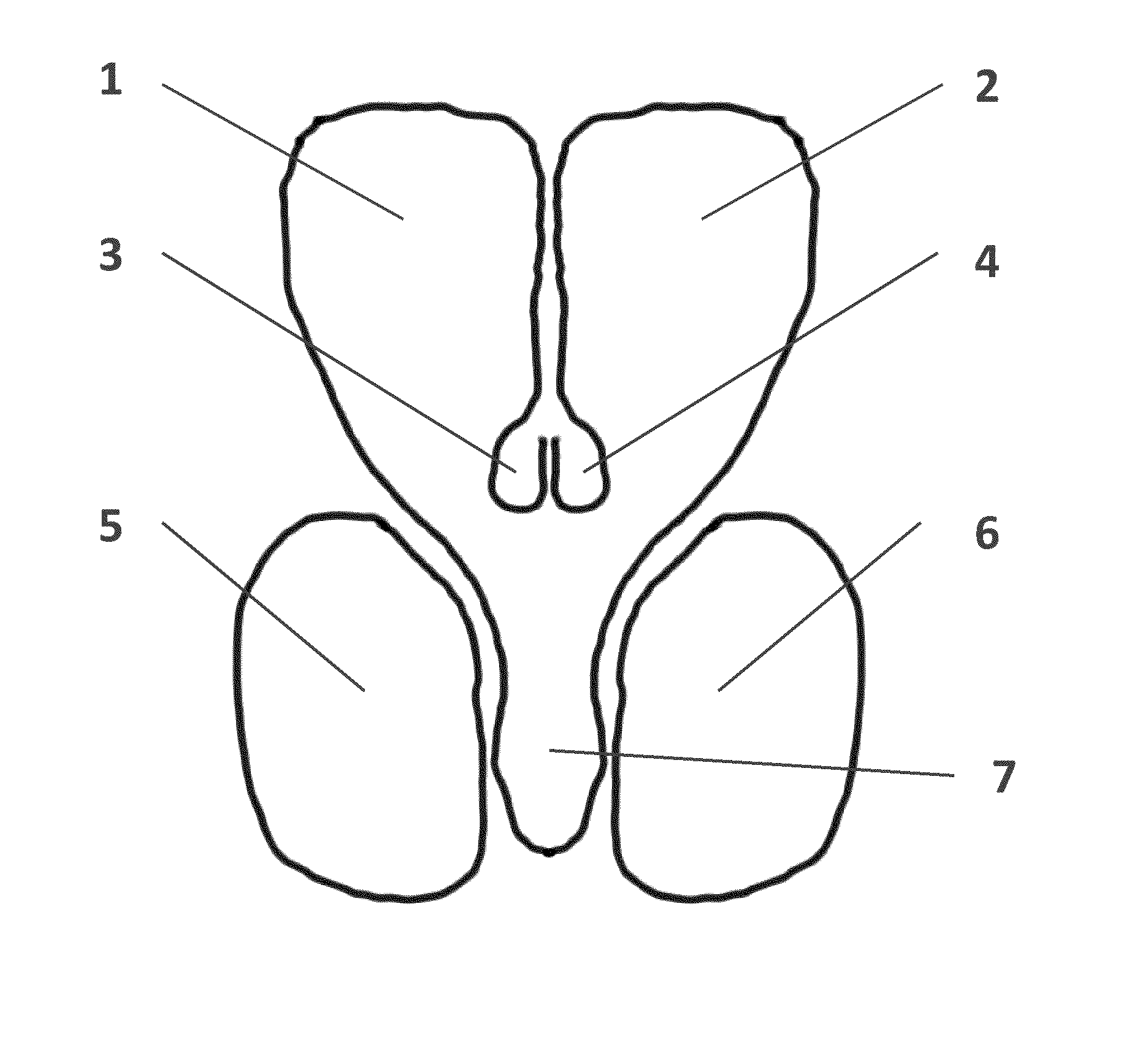 Methods and systems for intraventricular brain stimulation