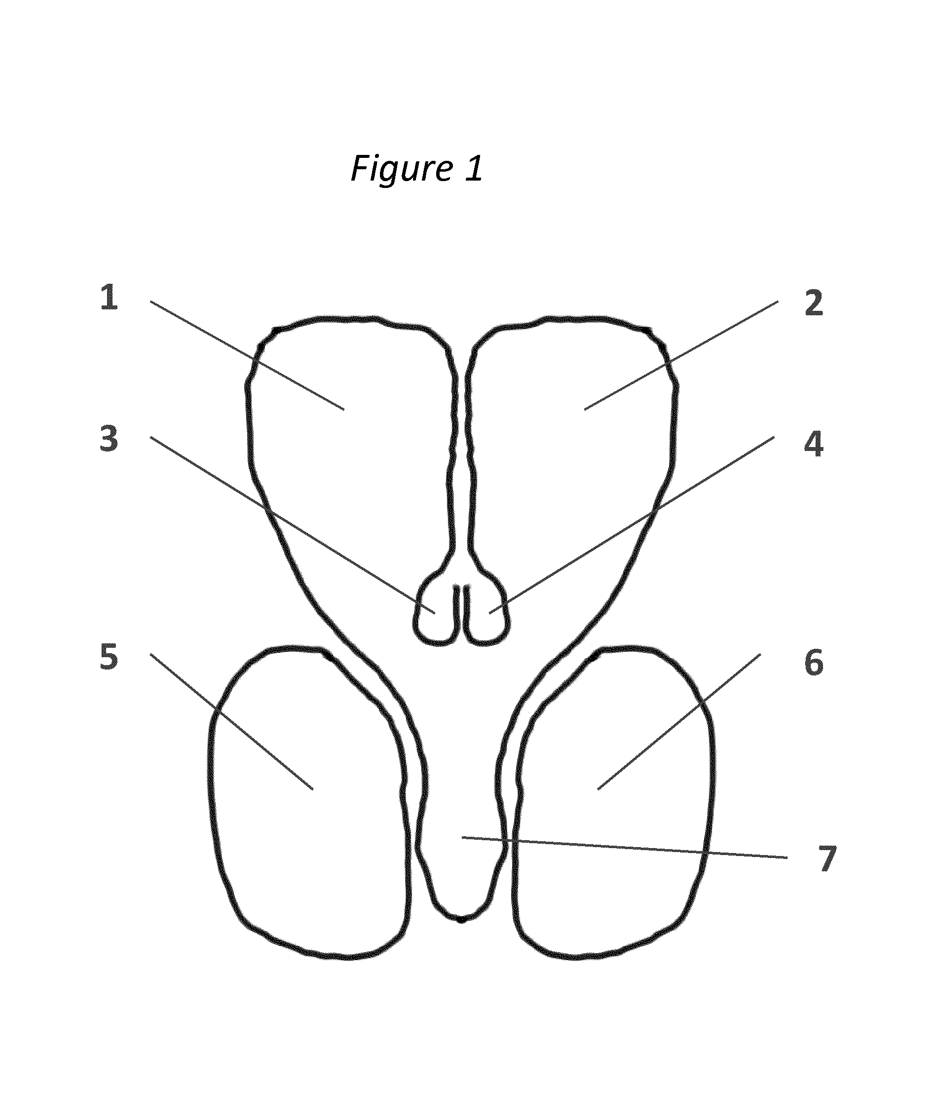 Methods and systems for intraventricular brain stimulation