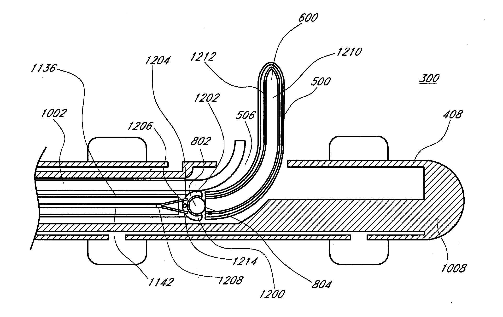 Method and apparatus for adjusting body lumens