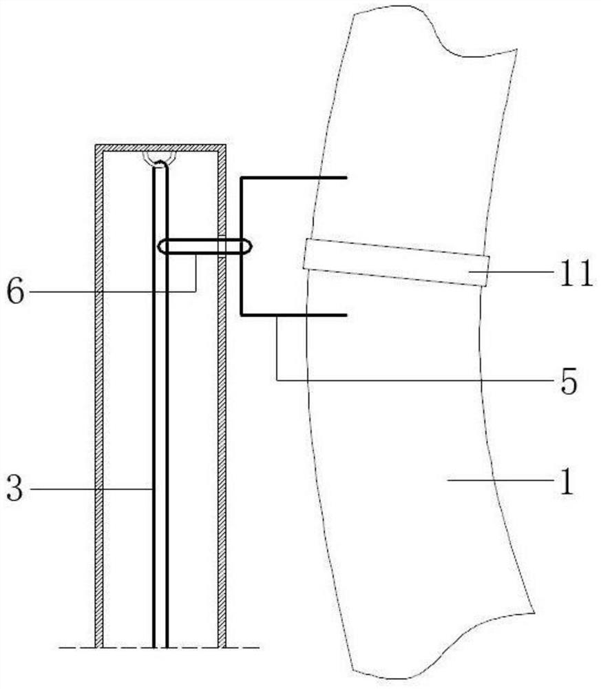 A suture-fixed and removable drainage tube