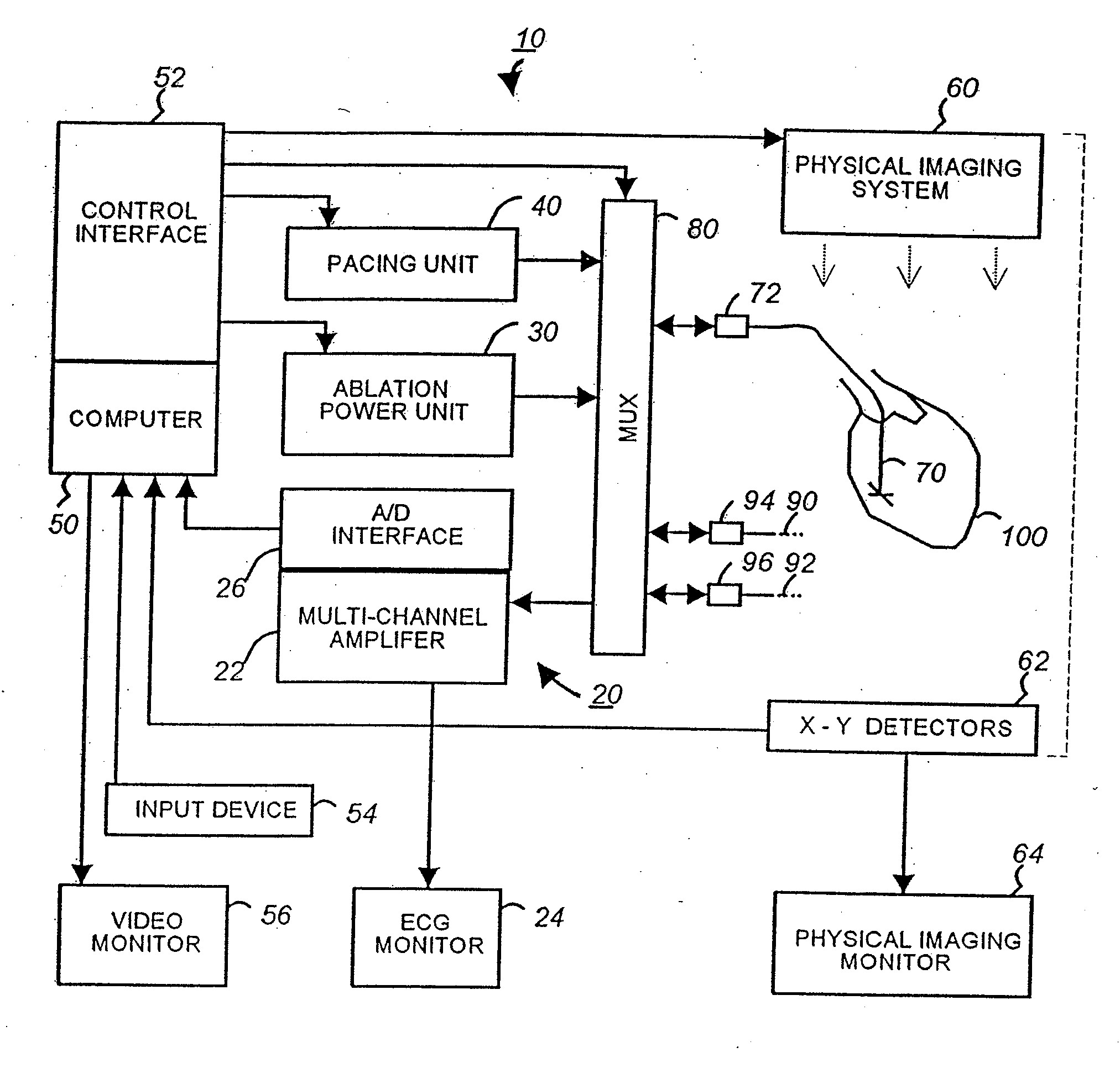 Apparatus And Method For Cardiac Ablation