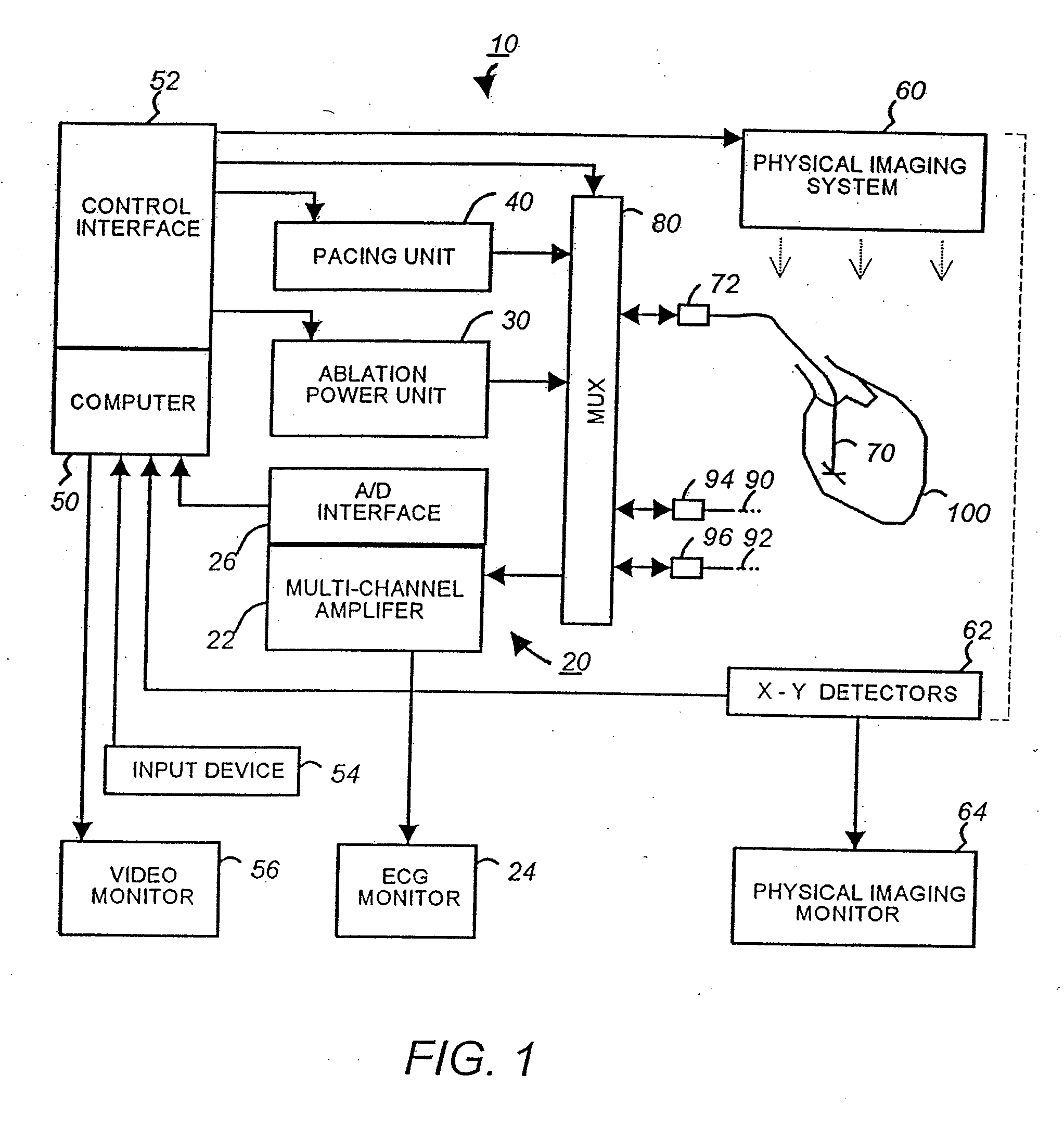 Apparatus And Method For Cardiac Ablation