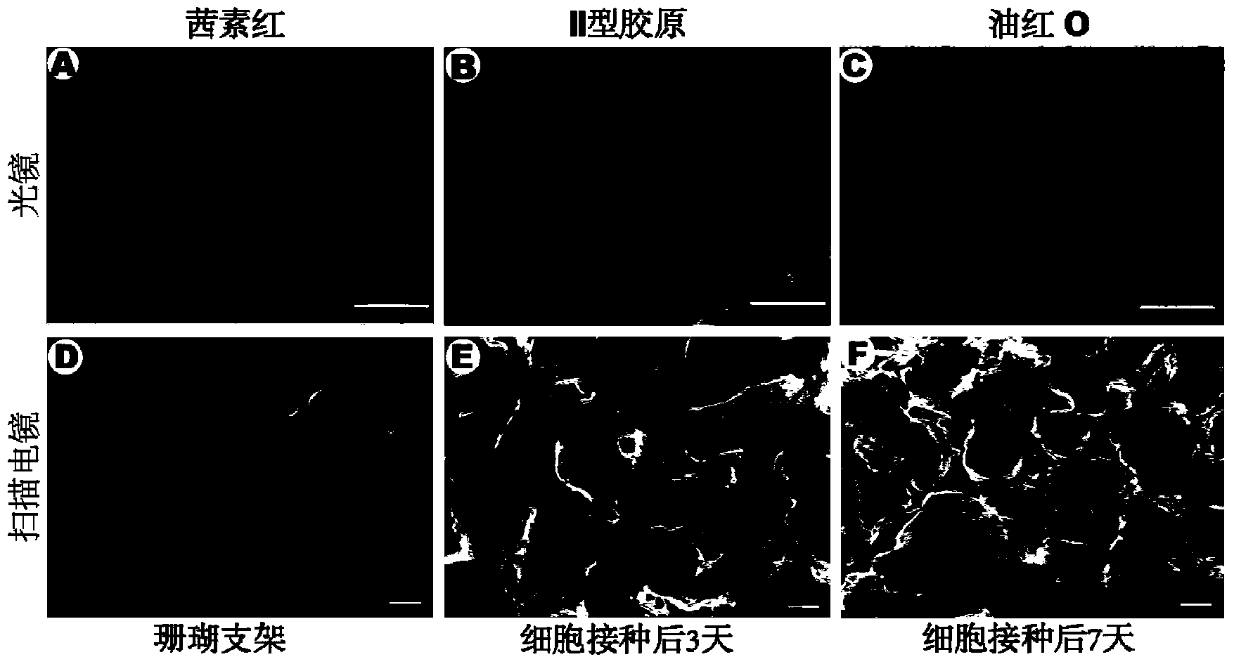 Tissue engineered bone constructed from allogeneic bone marrow mesenchymal stem cells and application thereof