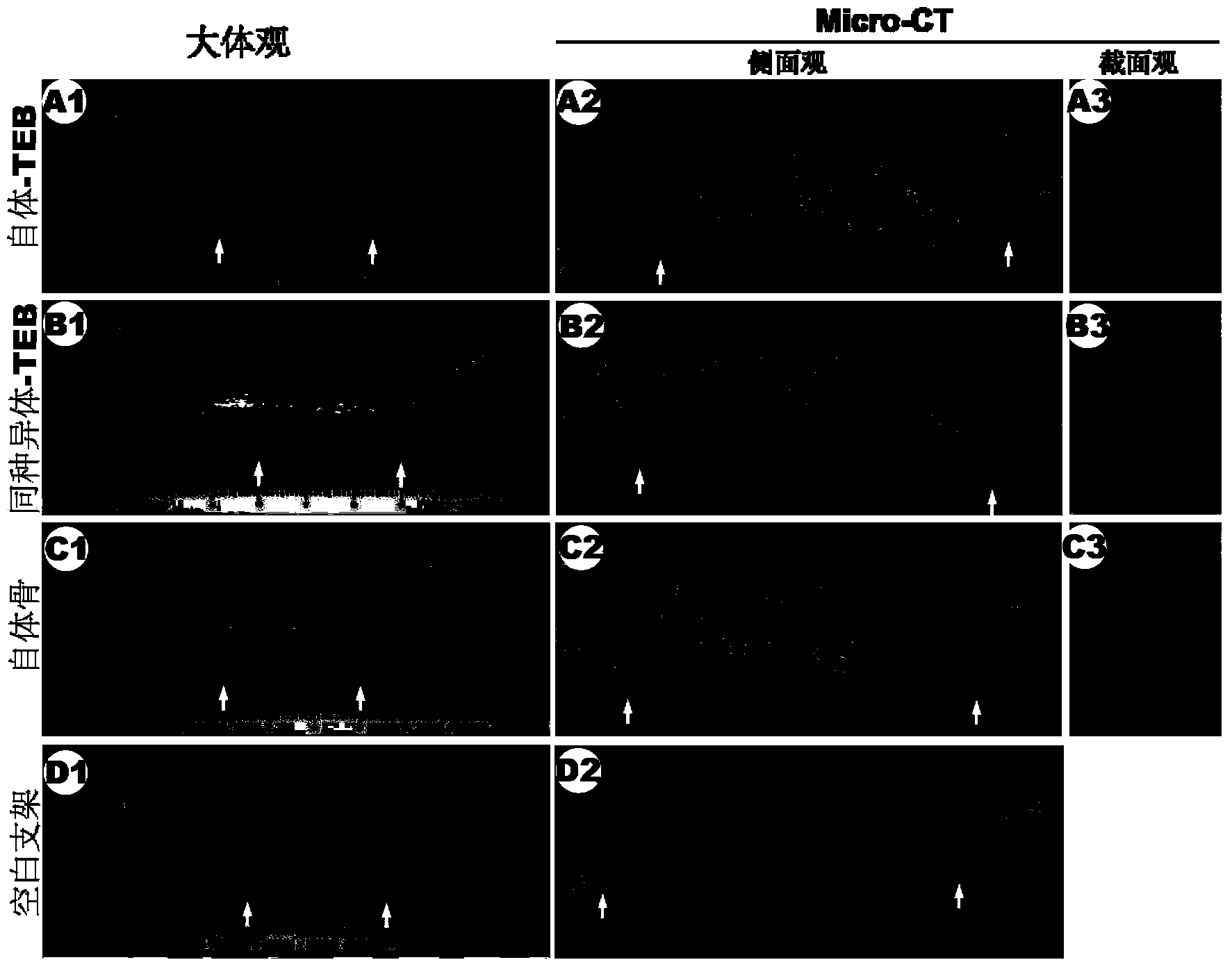 Tissue engineered bone constructed from allogeneic bone marrow mesenchymal stem cells and application thereof