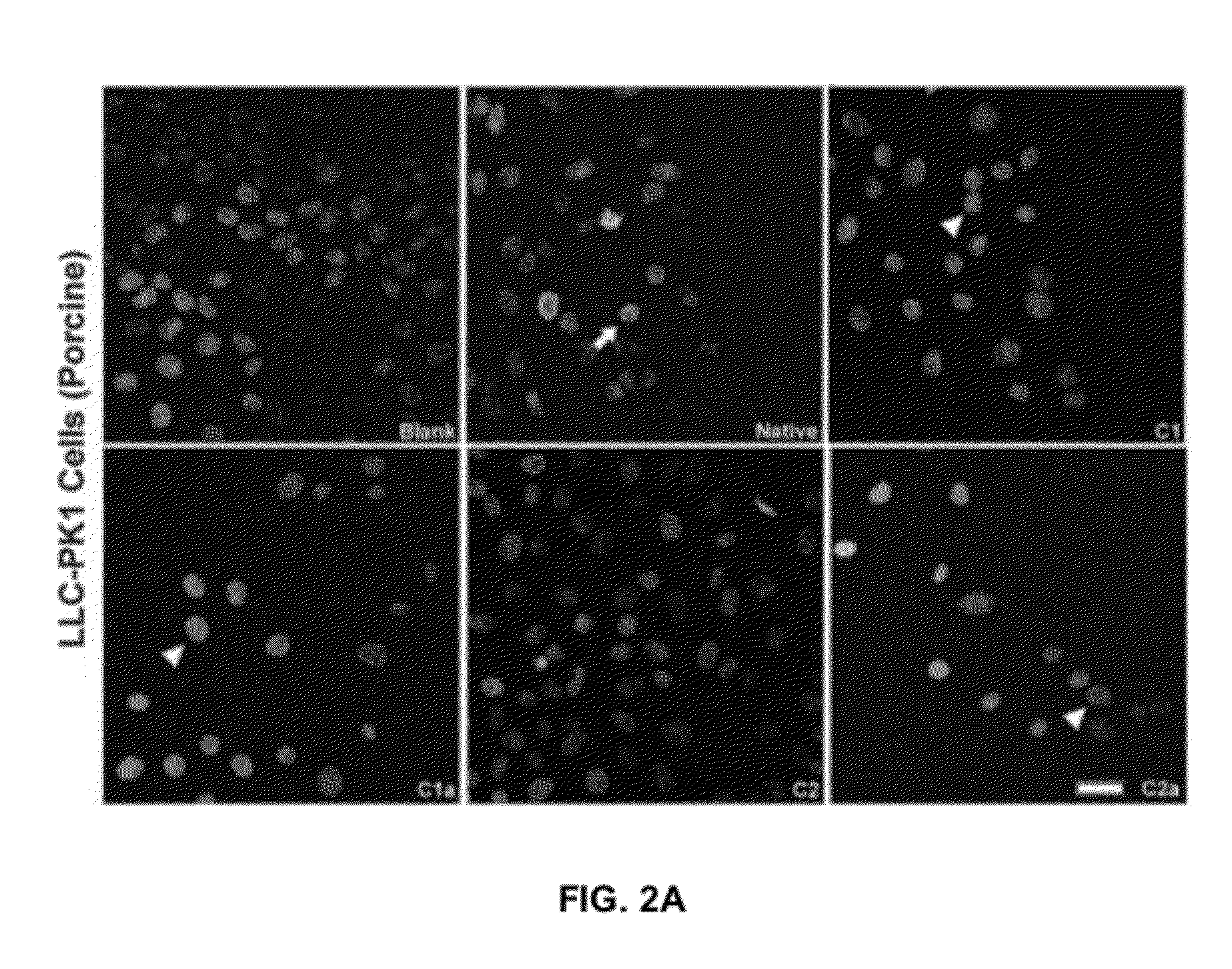 Materials and methods for treating diseases caused by genetic disorders using aminoglycosides and derivatives thereof which exhibit low nephrotoxicity