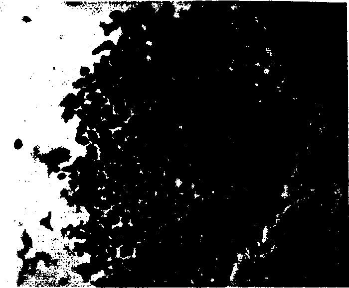 Method of separating derma epidermis stem cell