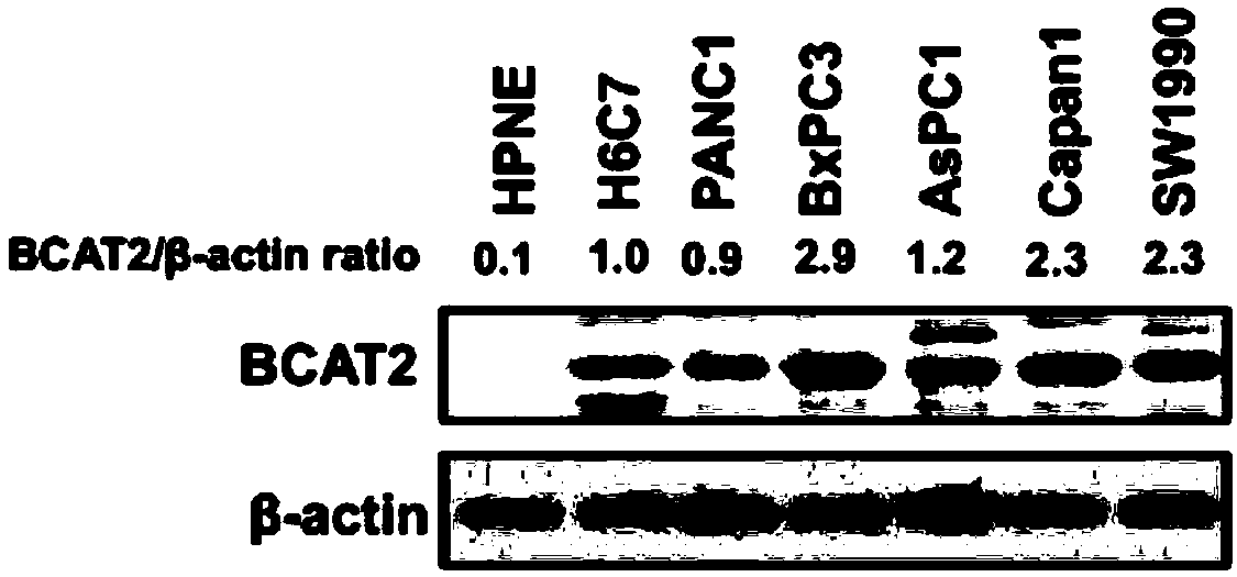 Medical composition for preventing or treating pancreatic cancer and reagent kit for detecting pancreatic cancer