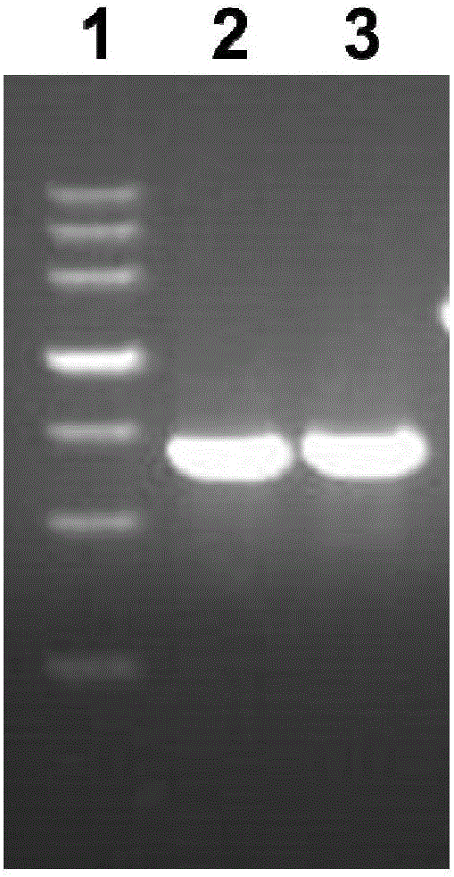 Pseudomonas aeruginosa recombinant protein Vac11 as well as preparation method and application