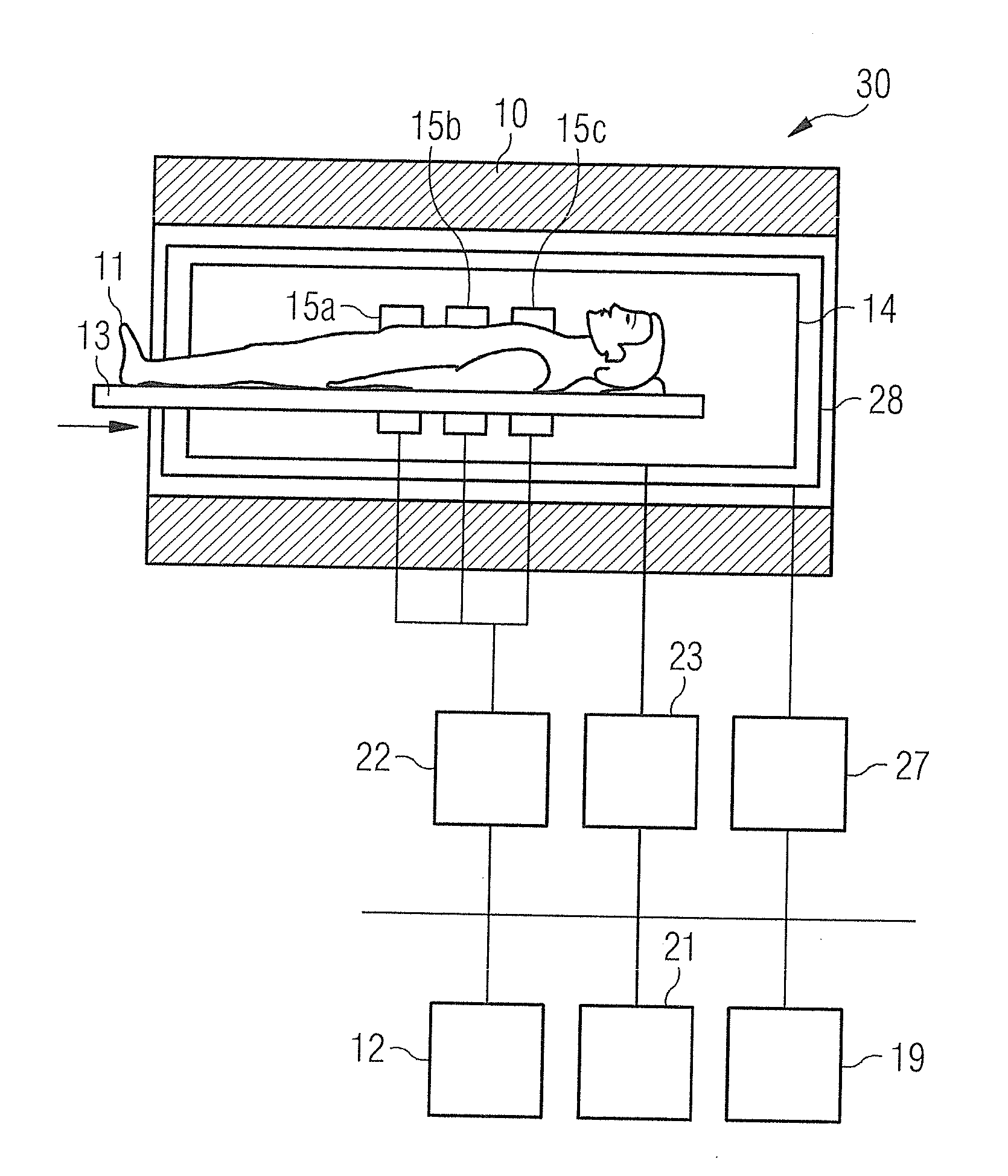 Method and magnetic resonance system to determine sample points of a random undersampling scheme for the acquisition of magnetic resonance data