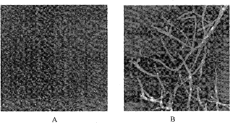 A beta aggregation inhibitor