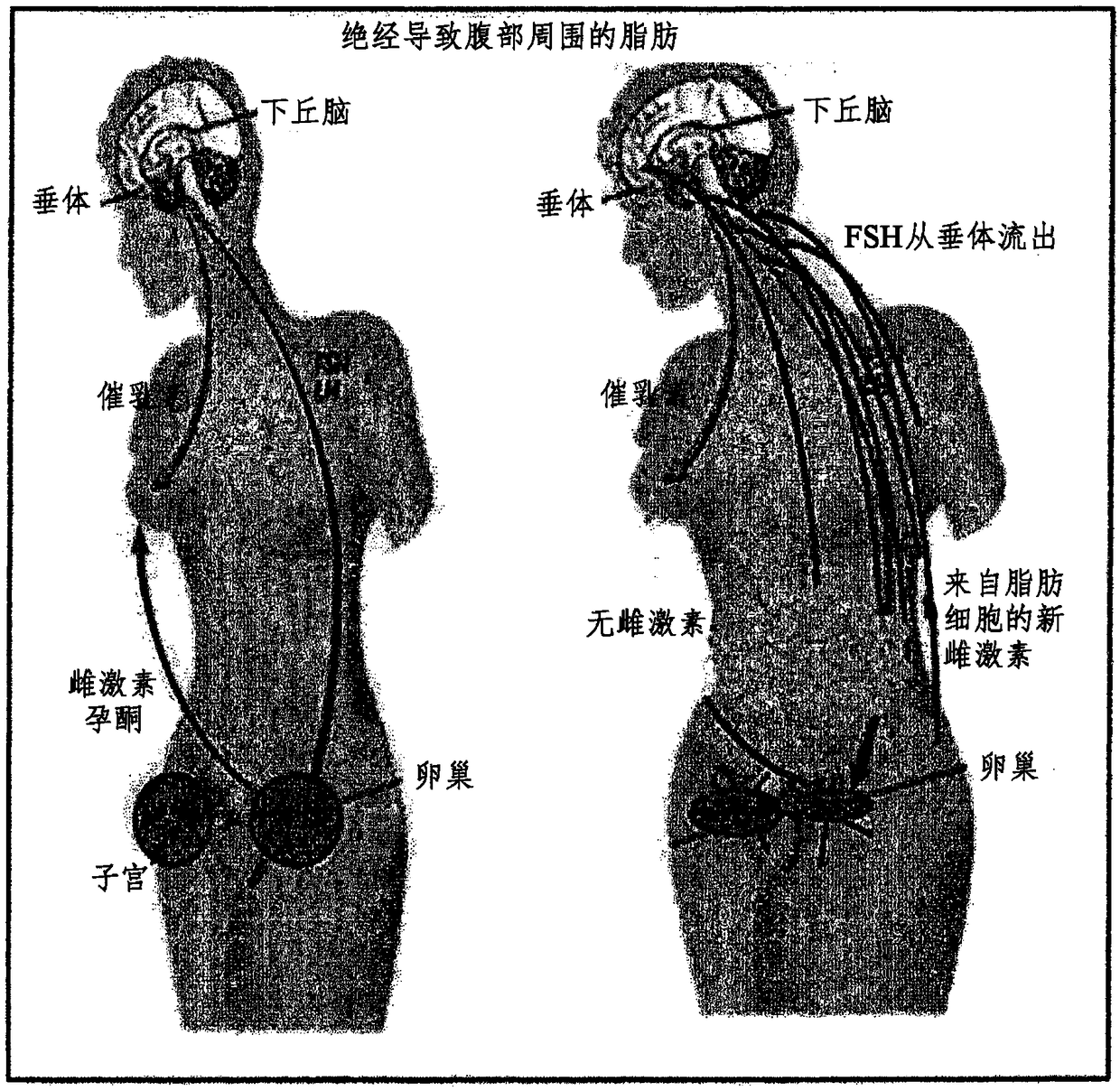 Composition, for preventing, remedying or treating female climacteric syndrome, containing loganin or derivative of same as active ingredient