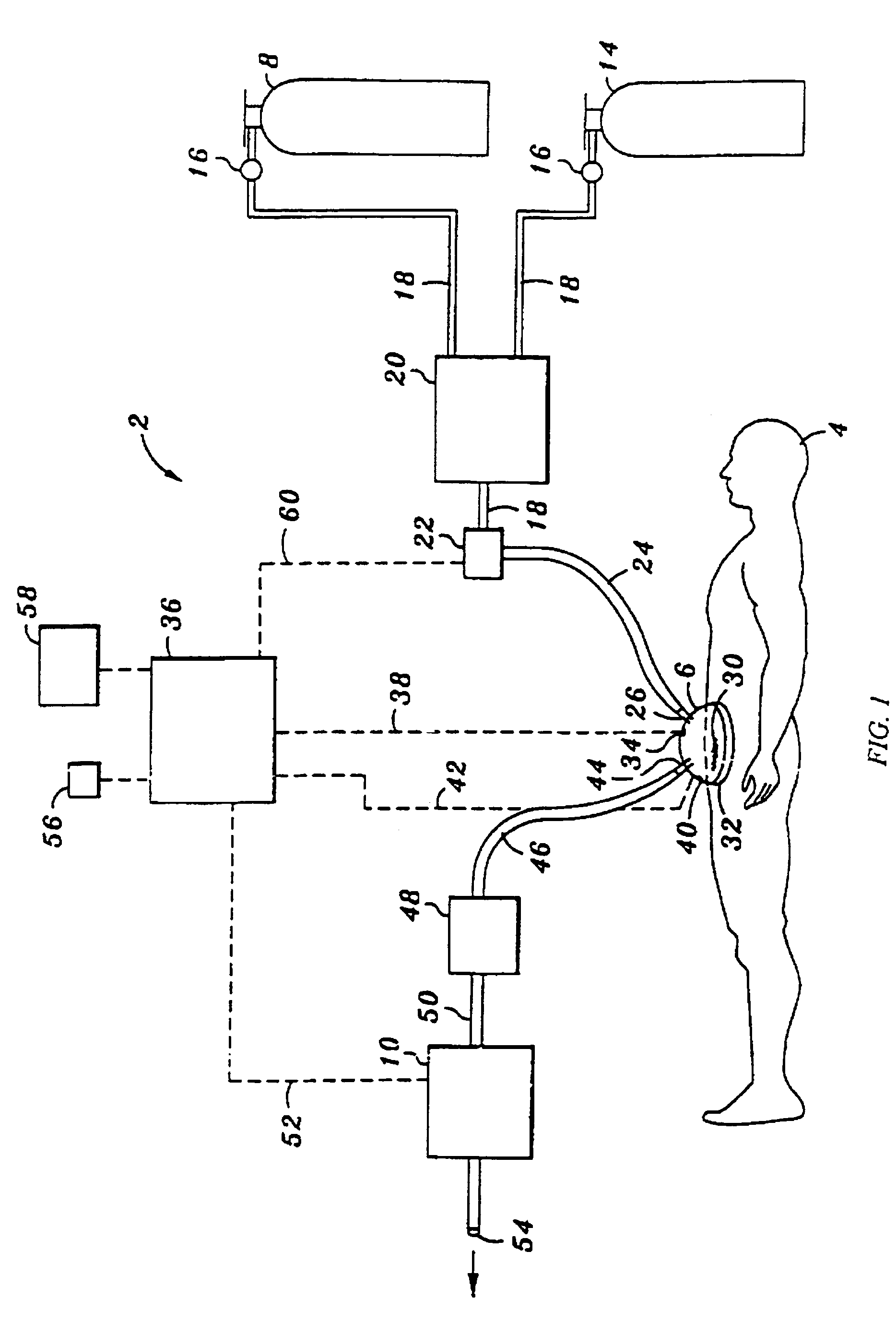 Device and method for treatment of wounds with nitric oxide