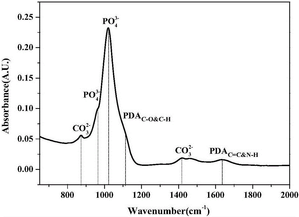 Preparation method of dental implant and composite surface thereof