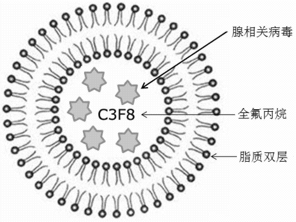 Lipid ultrasound microbubble mediated adeno-associated virus gene transfection preparation and preparation technology thereof