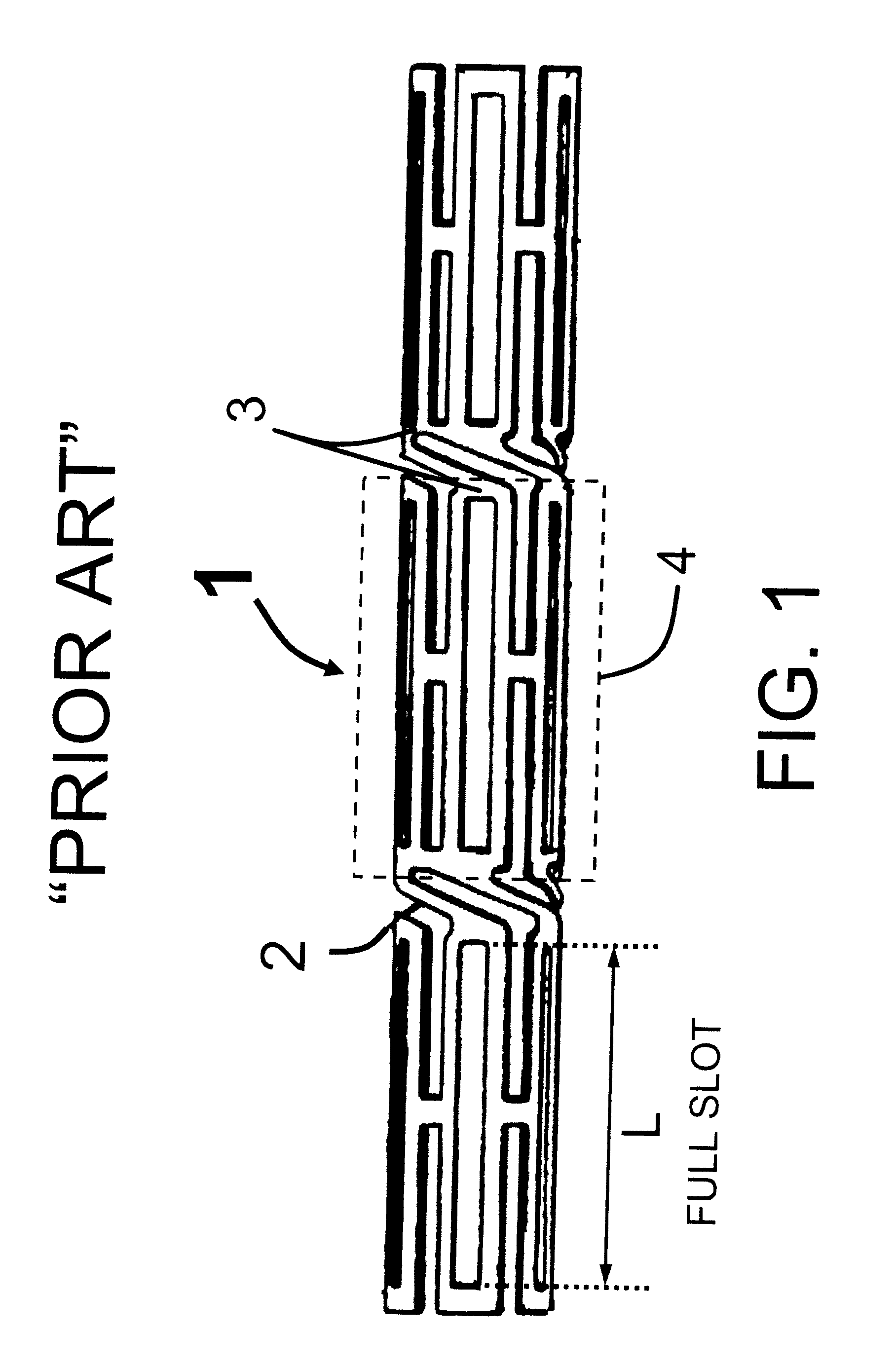 Hybrid stent with helical connectors