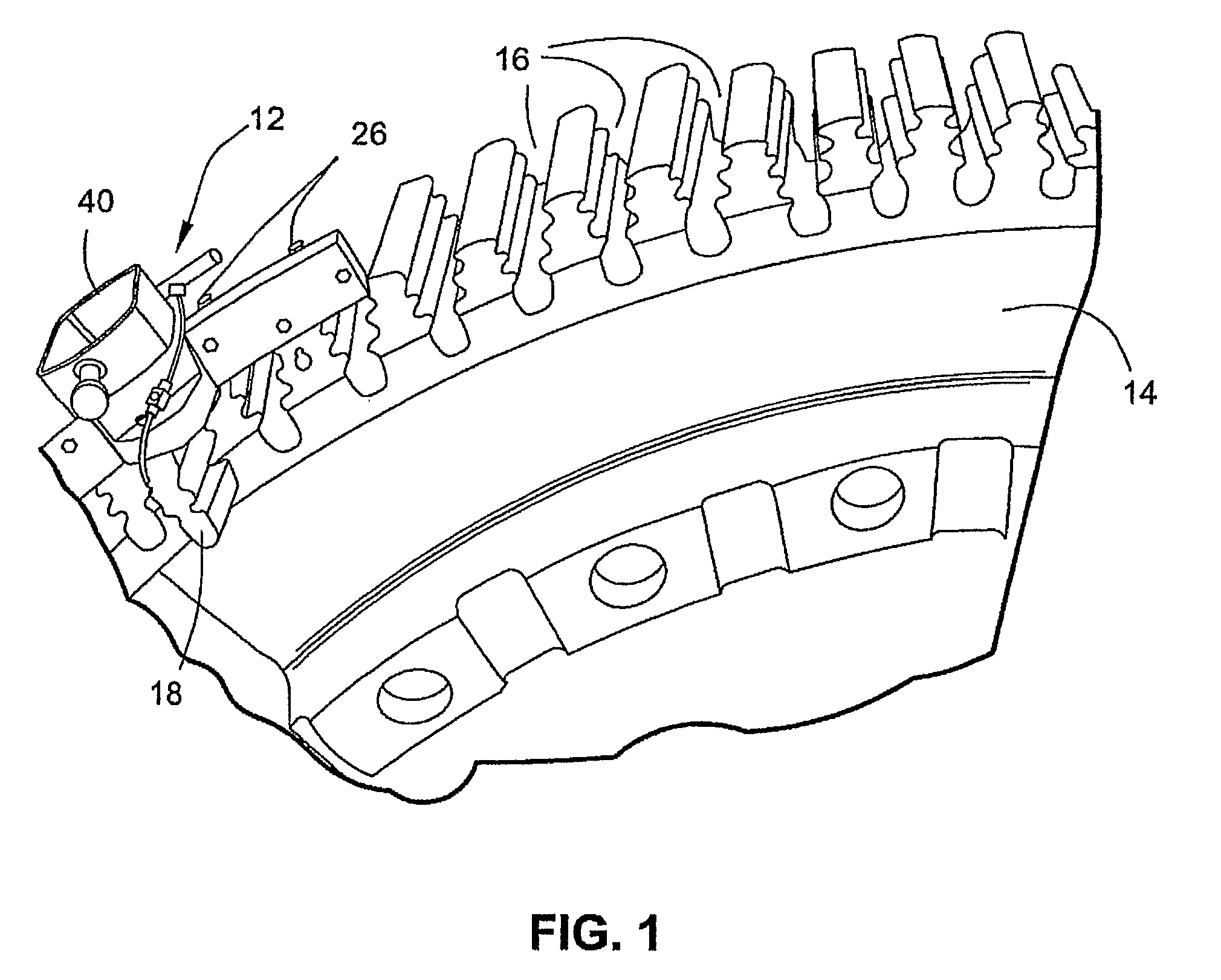 Ultrasonic peening treatment of assembled components