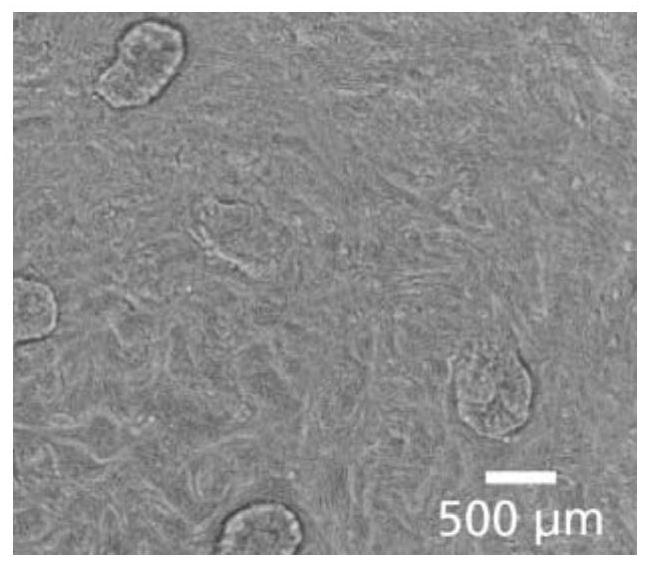 Molecular culture medium for culturing small intestine organoids of pigs