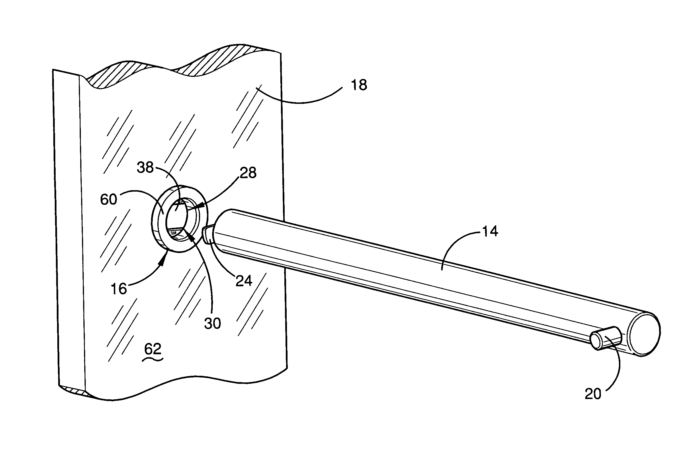 Support arm system