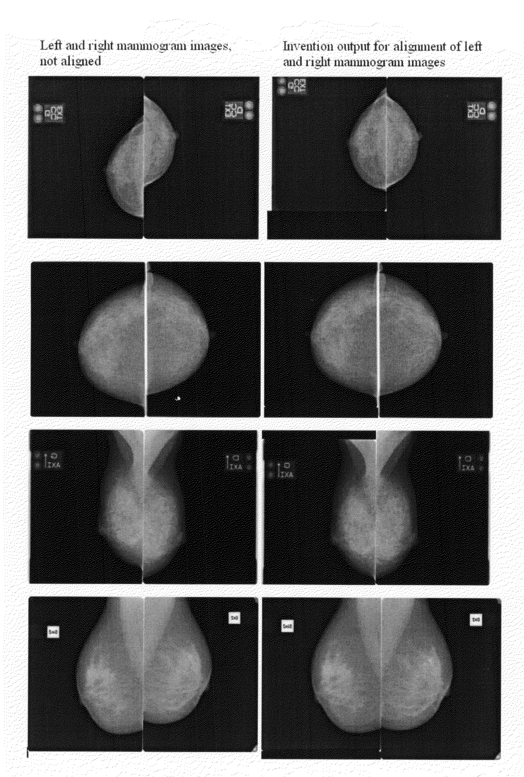 Method and apparatus for image alignment