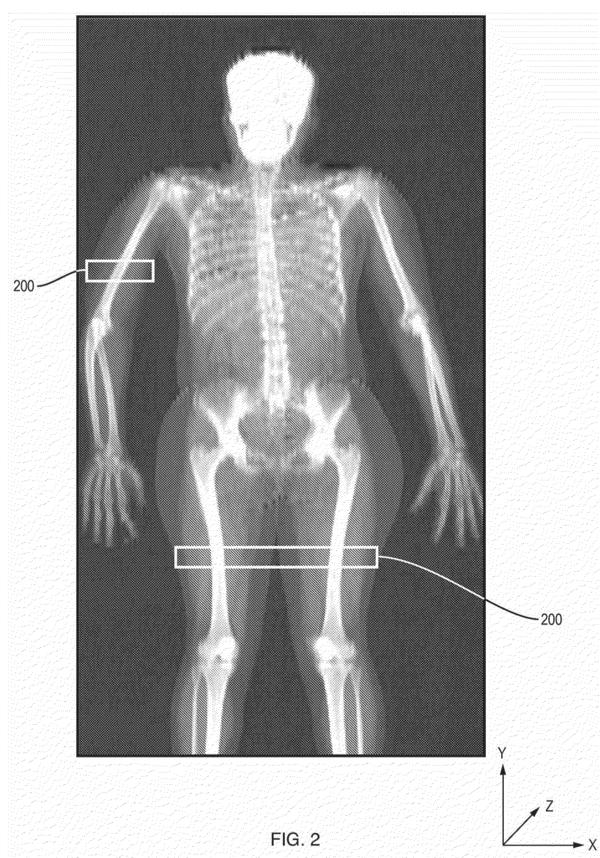 Measuring intramuscular fat