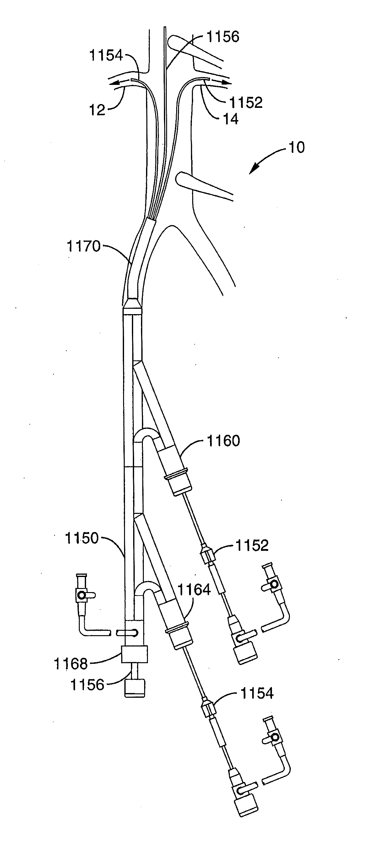 Method and Apparatus for Intra-Aortic Substance Delivery to a Branch Vessel