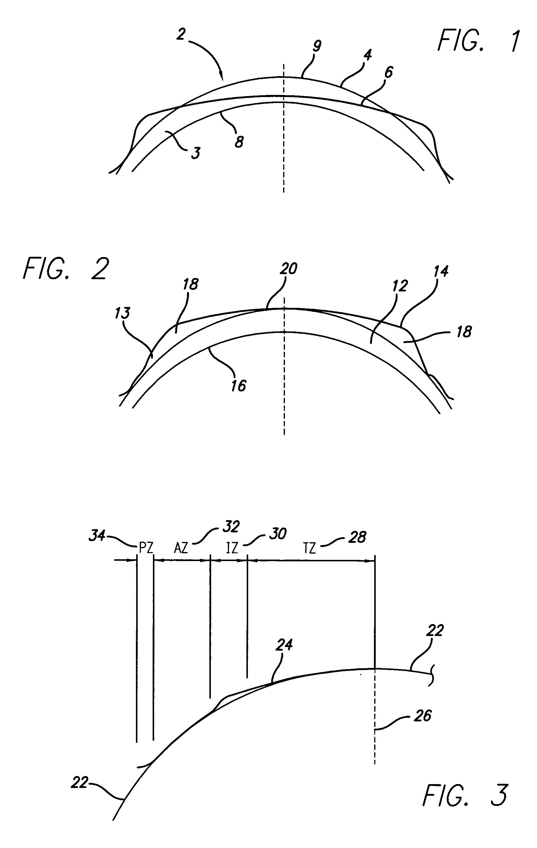 Orthokeratological contact lenses and design methods therefor