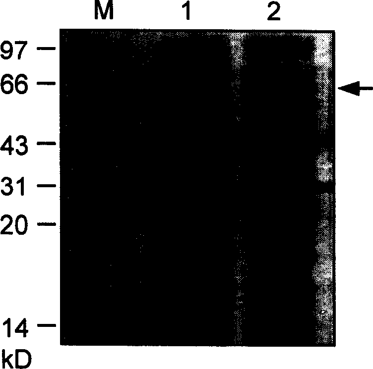 Rice mitogen-activated protein kinase and its coded gene and use