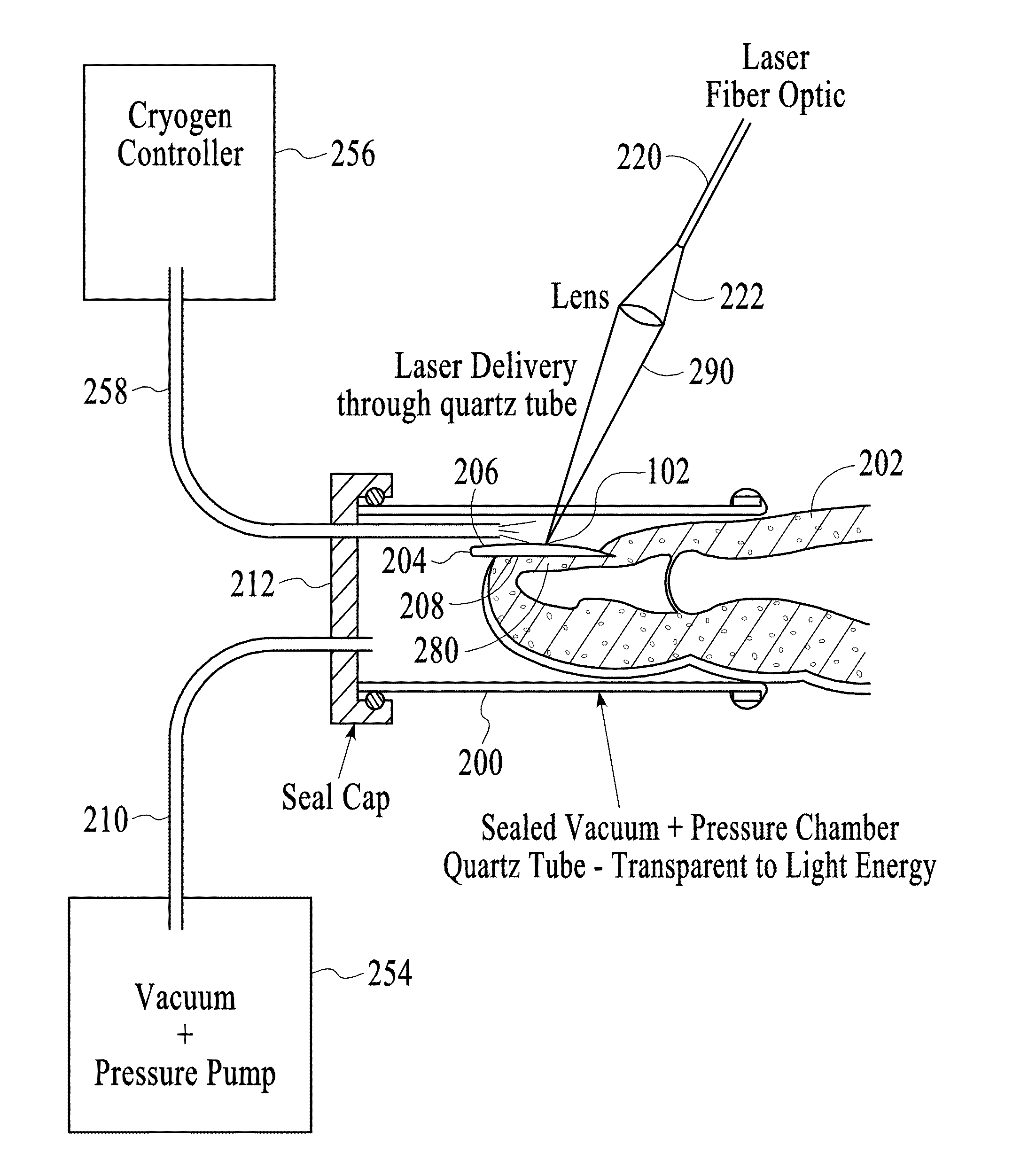 Apparatus and Method for Treatment of Microbial Infection