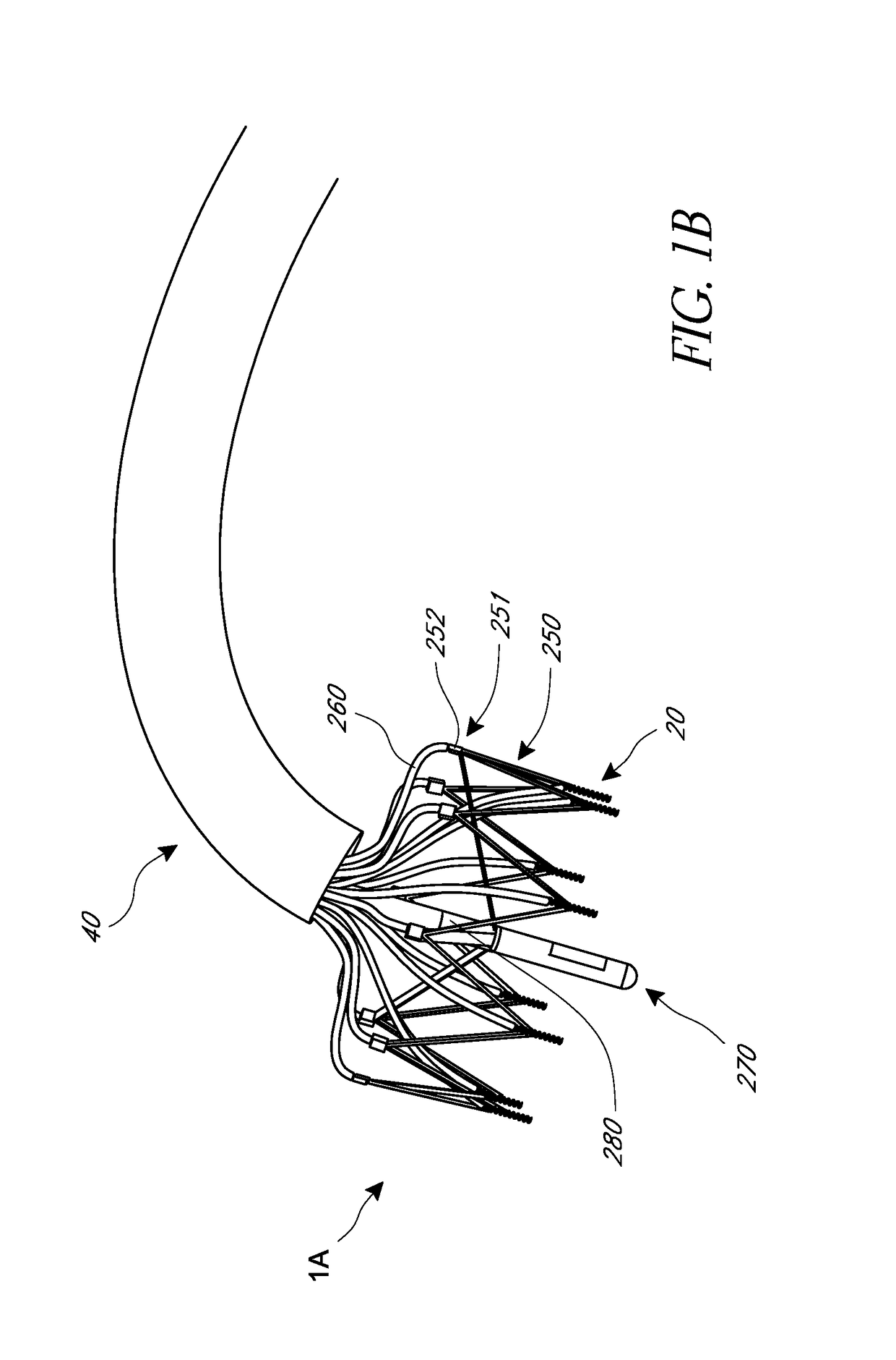 Methods for delivery of heart valve devices using intravascular ultrasound imaging