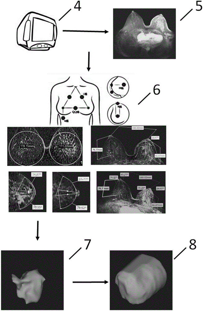 Breast prosthesis manufacturing method based on three-dimensional printing technology