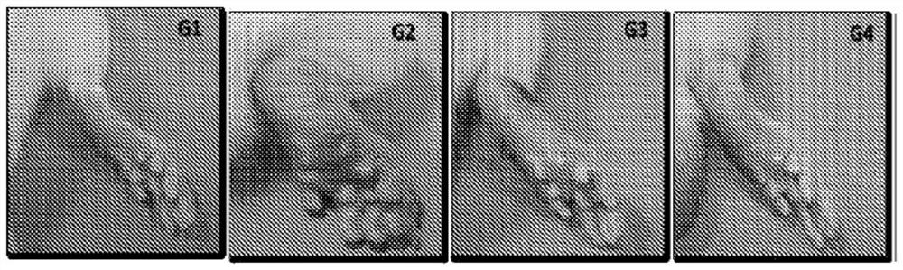 Protein for treatment of inflammatory diseases