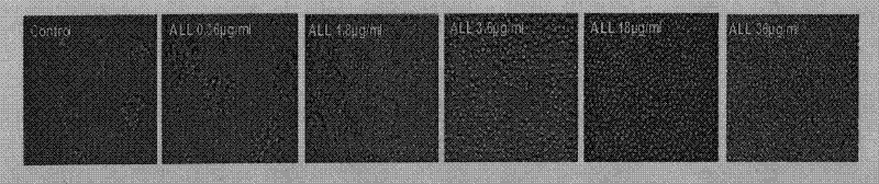 Method for promoting CD4+T proliferation and activation and suppressing Jurkat T cell by using red cassia tree lectin