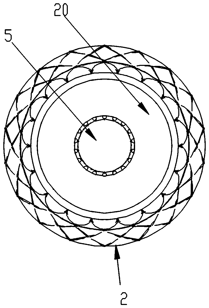 Esophageal tracheal fistula occlusion stent and inserter thereof and inserting method thereof