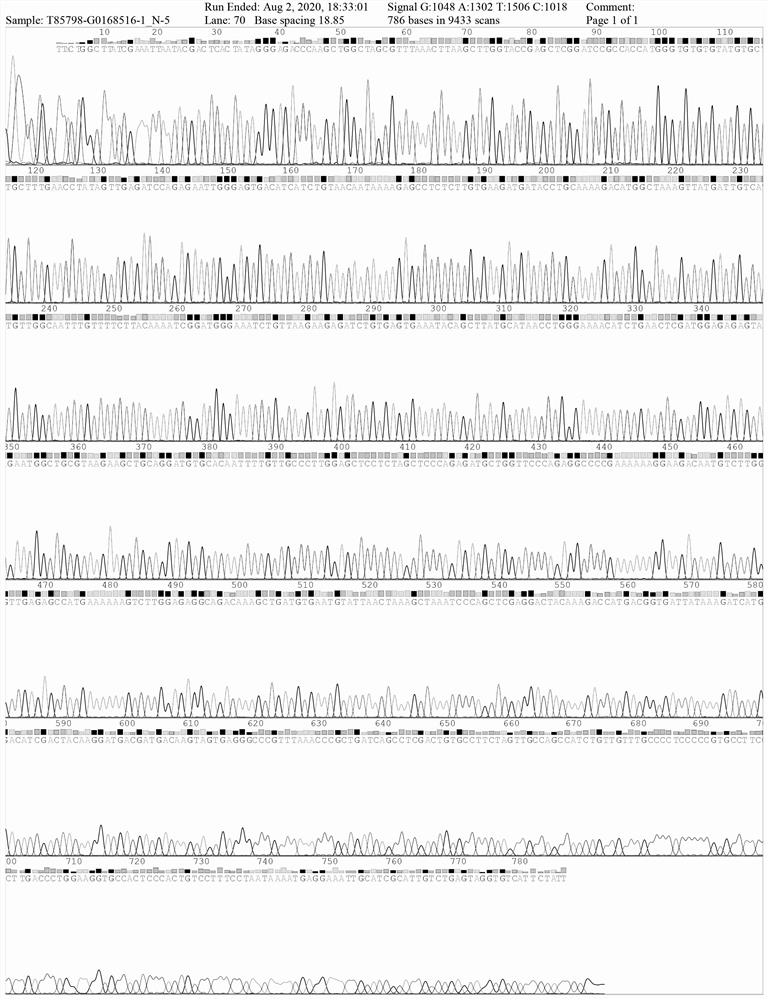 Human parathyroid hormone eukaryotic expression recombinant plasmid vector and construction method thereof