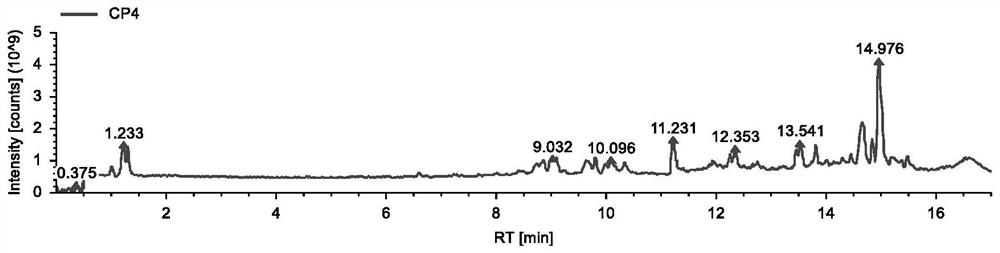 Spina gleditsiae-based bacteriostatic and antiallergic shampoo and preparation method thereof