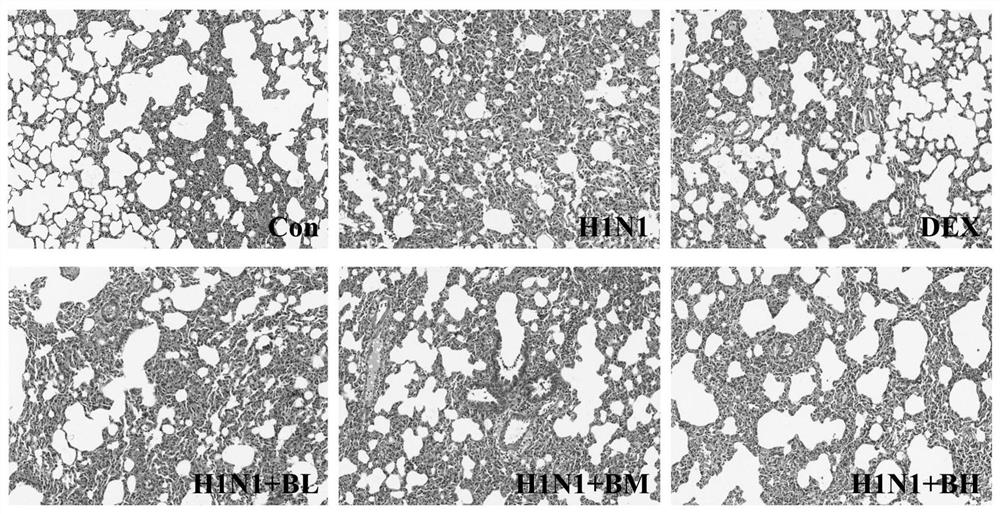 Application of Baitouweng decoction in preparation of medicine for treating pneumonia