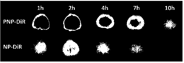 Targeting nano drug delivery system aiming at brain glioma and preparation methods and application thereof