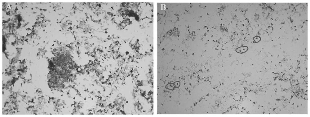 A kind of Brevibacillus spp., antibacterial lipopeptide and its application in agriculture and food