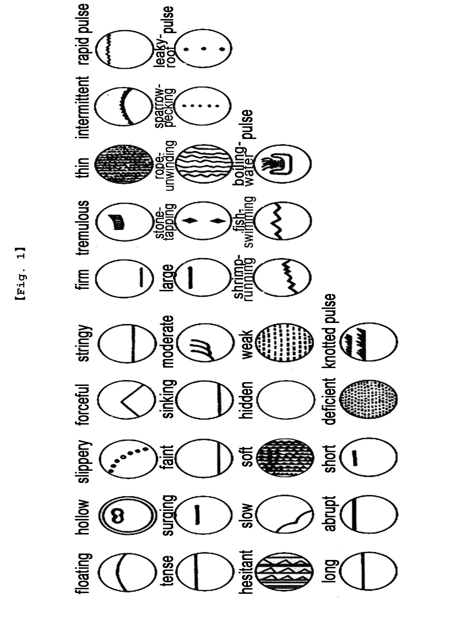 Diagnosis system of deficient and forceful pulse