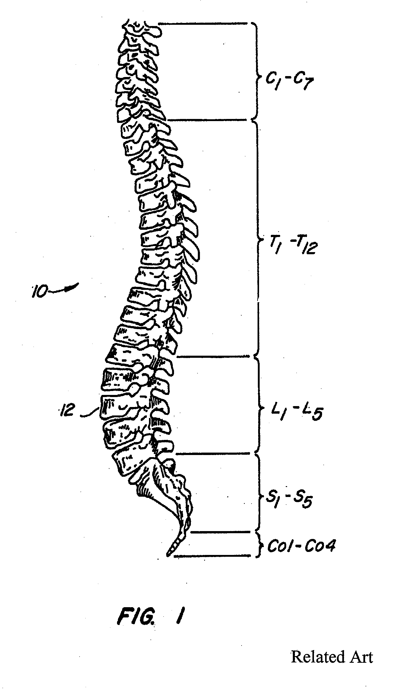 Polymeric joint complex and methods of use