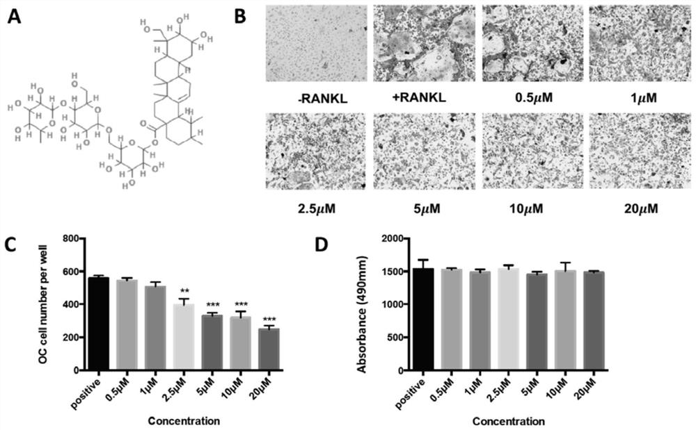 Application of asiaticoside in the treatment of abnormal bone metabolism