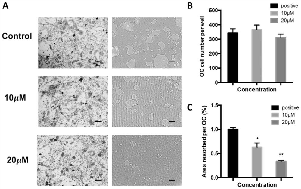 Application of asiaticoside in the treatment of abnormal bone metabolism