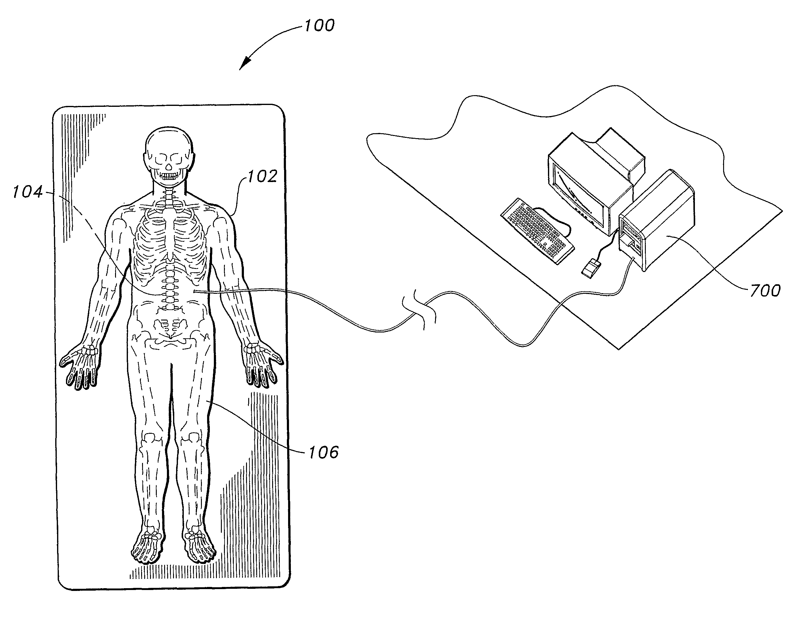 Orthopedic procedures training simulator