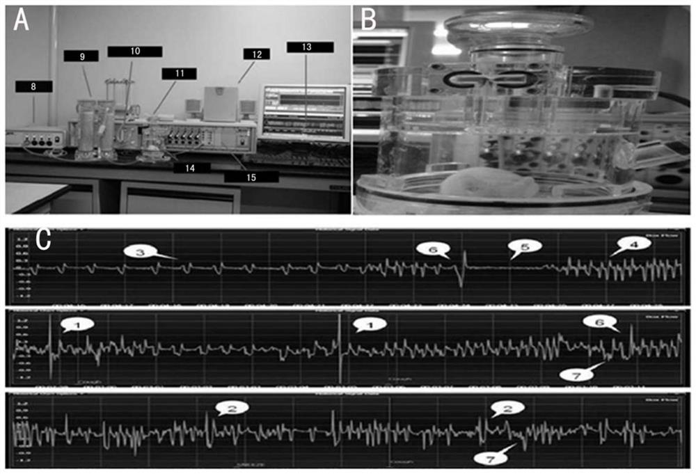 A method of establishing and detecting the establishment and detection method of a mouse model of eosinophilic bronchitis